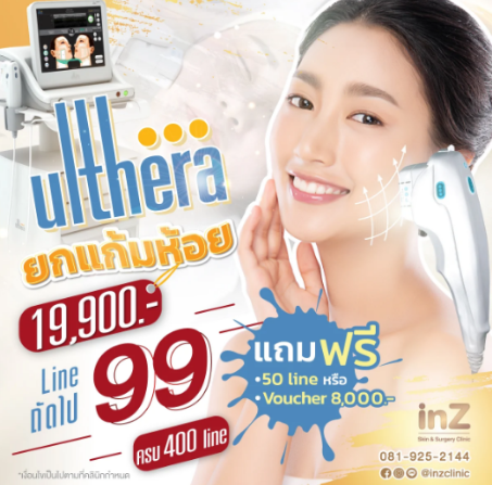 โปรโมชั่น 1